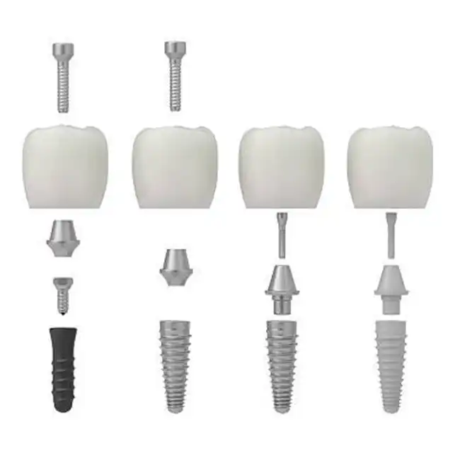 Milled Ttitanium Bar Dental